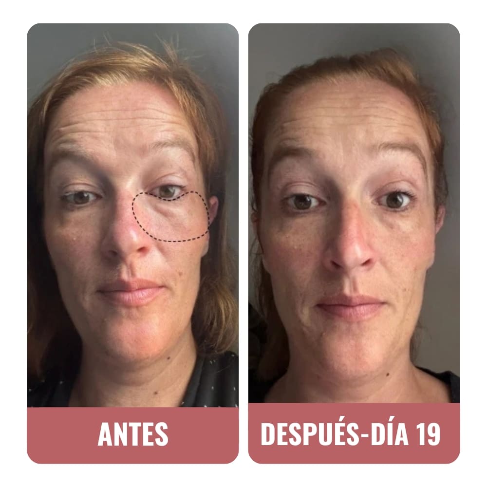 Un efecto inmediato en la textura de mi piel.