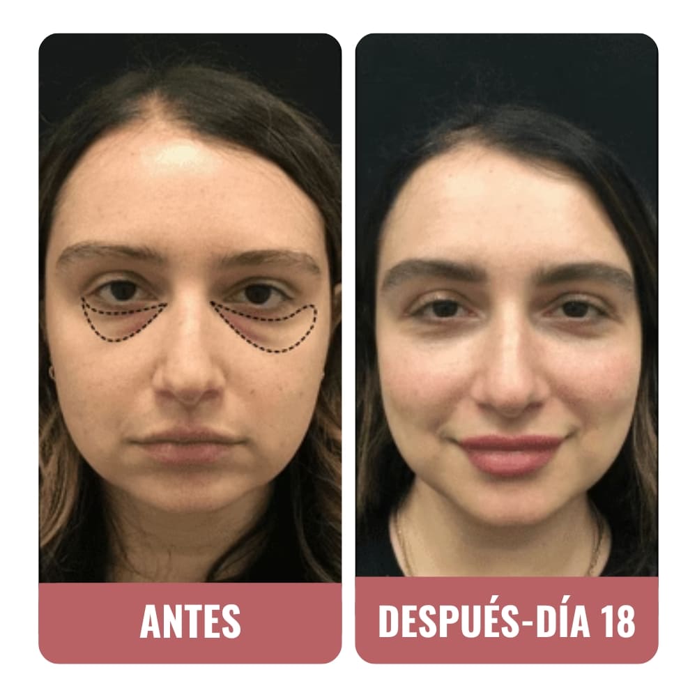 He probado muchos correctores de ojeras.