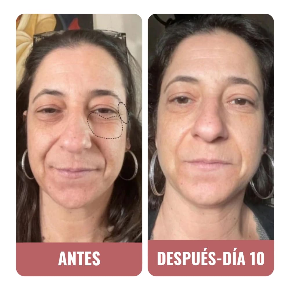 Mi contorno de ojos está más liso y menos oscuro.