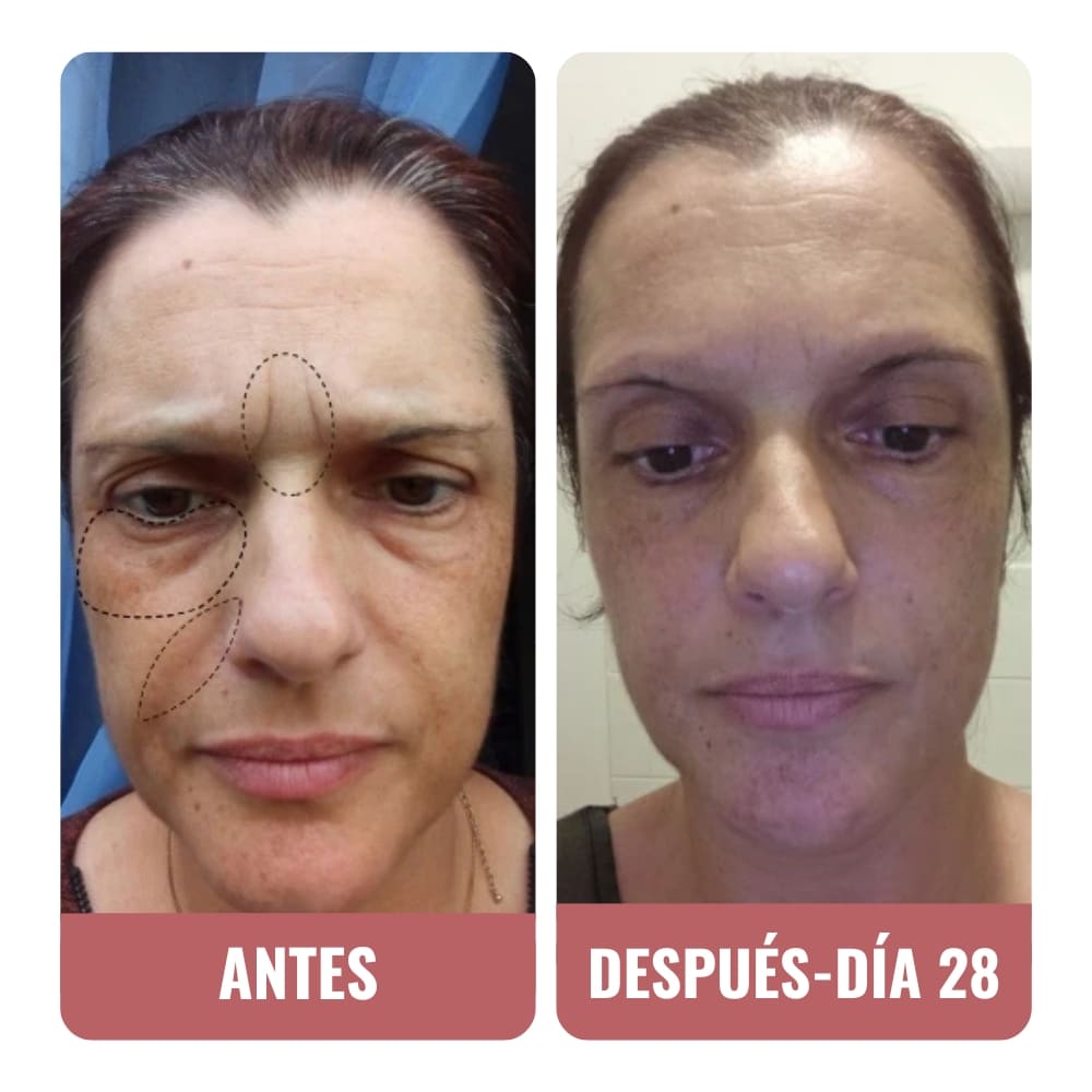 Esta crema Wombea es impresionante.