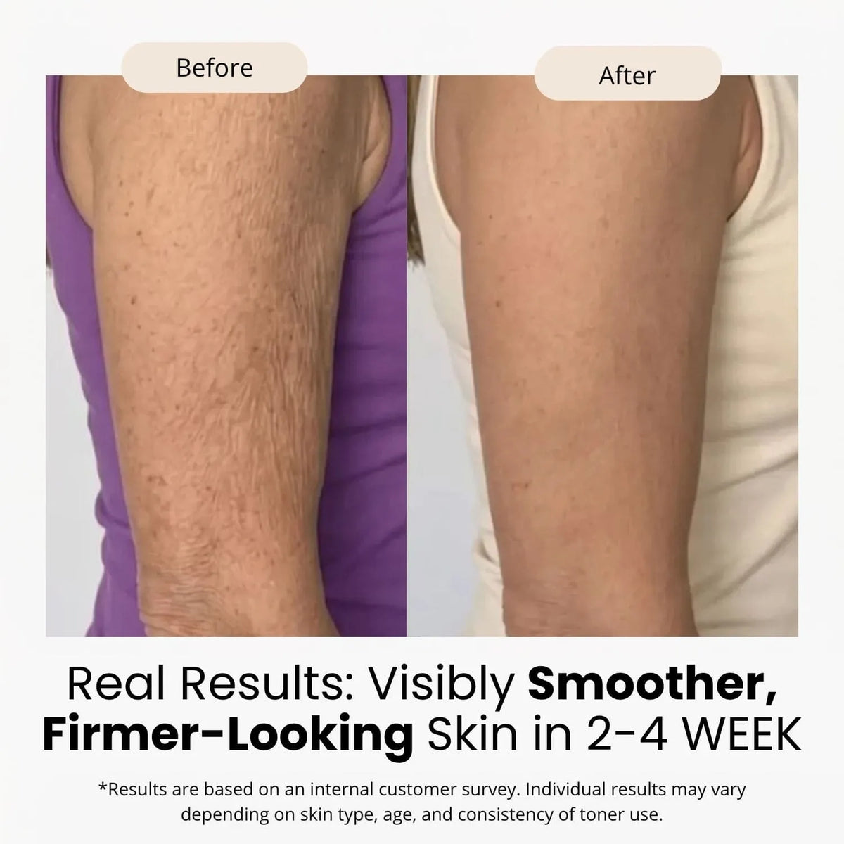 Korean Silk Peptide + EGF Belly Firming Toner