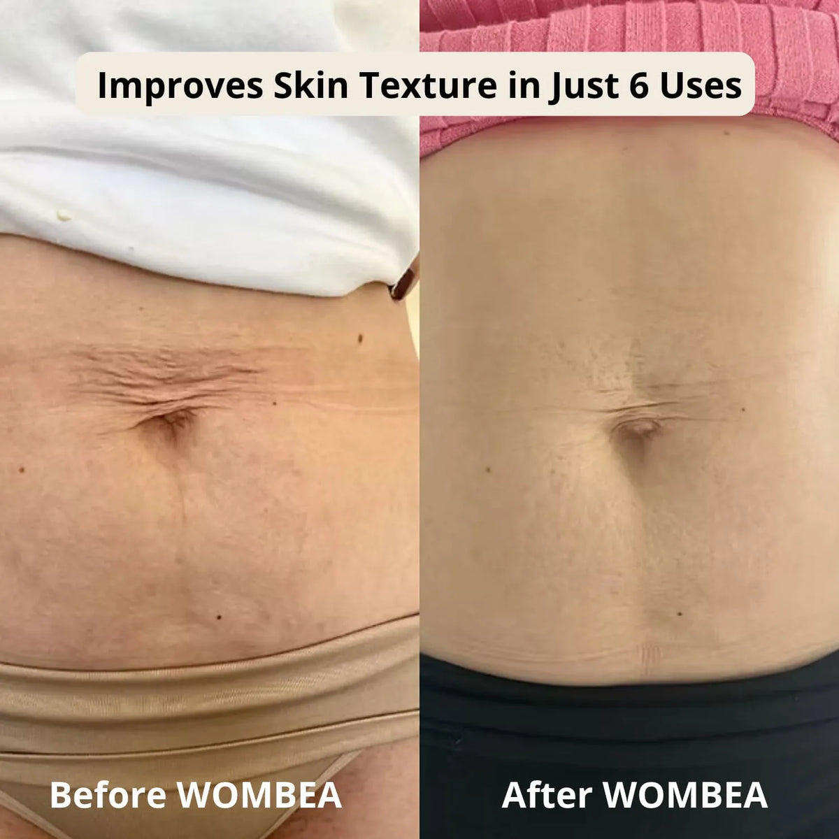 Korean Silk Peptide + EGF Belly Firming Toner