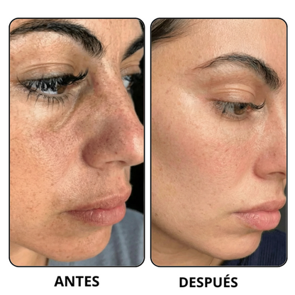 Peel Shot Coreano-Elimina las impurezas y realza tu piel