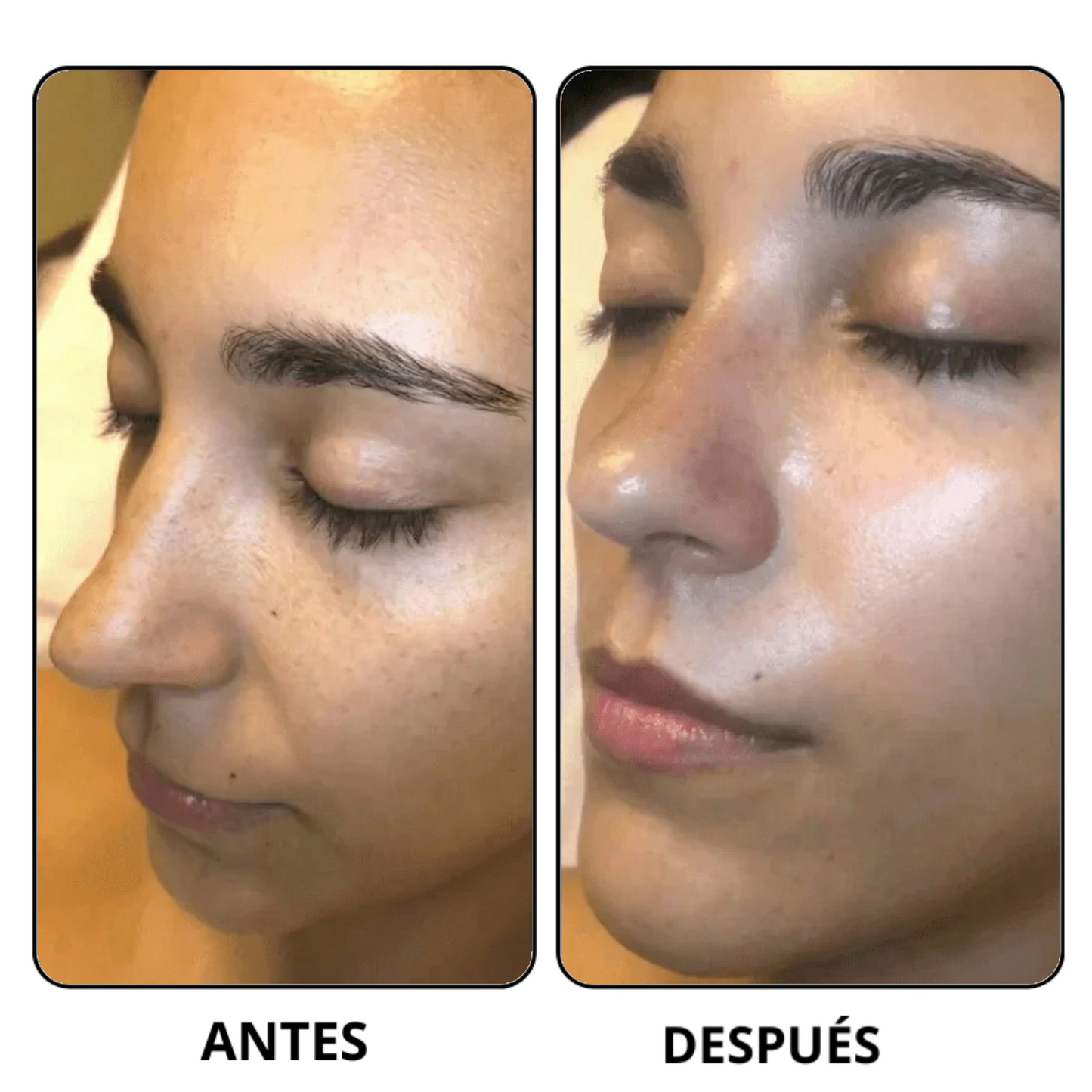 Peel Shot Coreano-Elimina las impurezas y realza tu piel