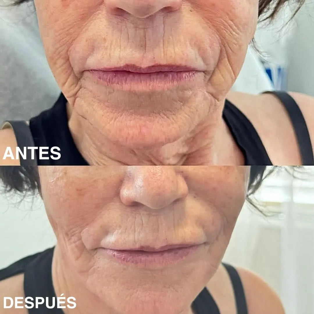 Bálsamo Rellenador de Biocolágeno con PDRN