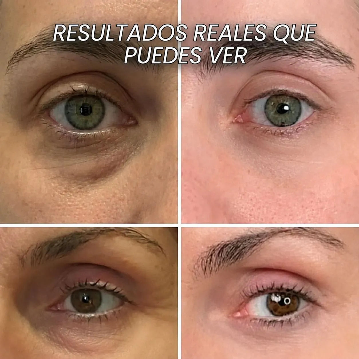 Bálsamo Rellenador de Biocolágeno con PDRN