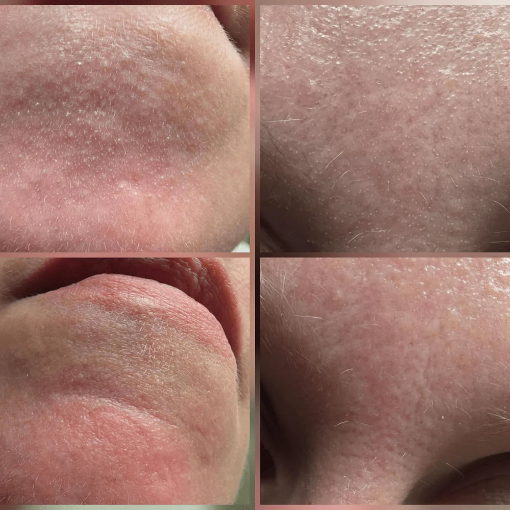 Resultados reales en pocos usos