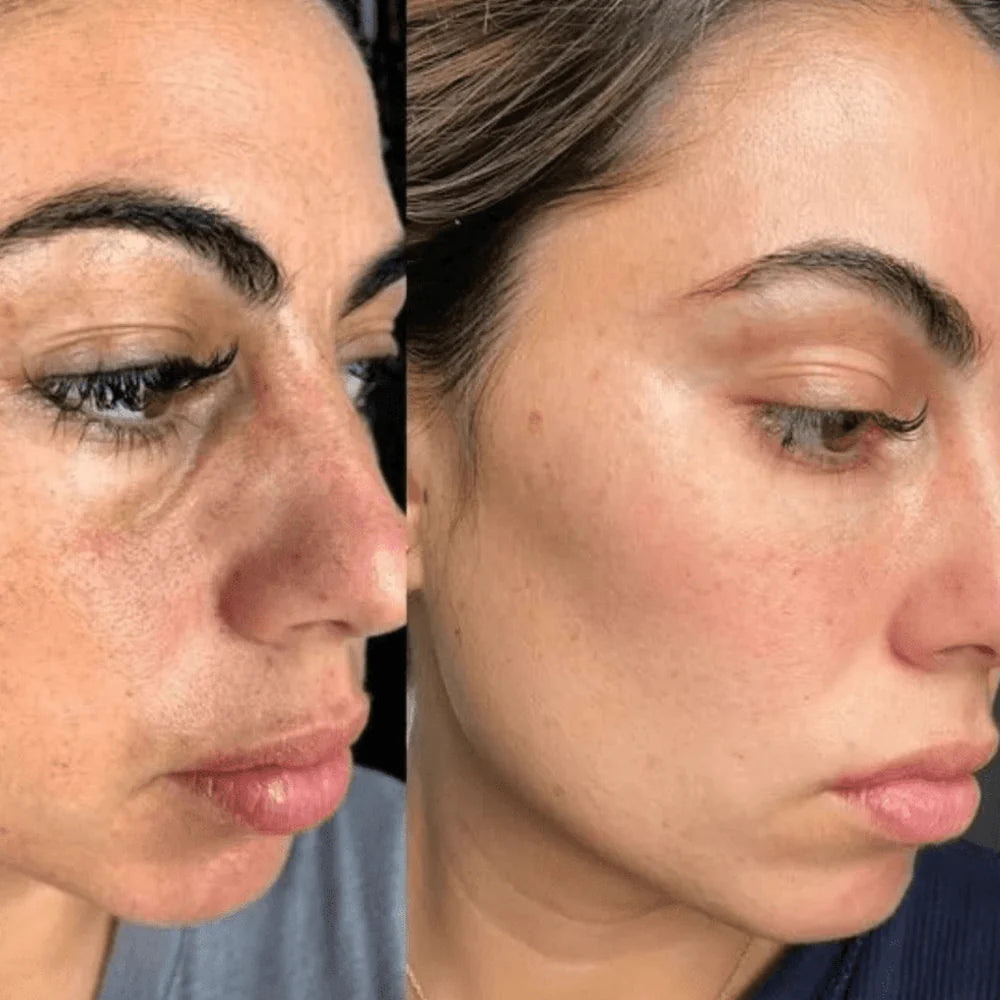 Resultados en tiempo récord