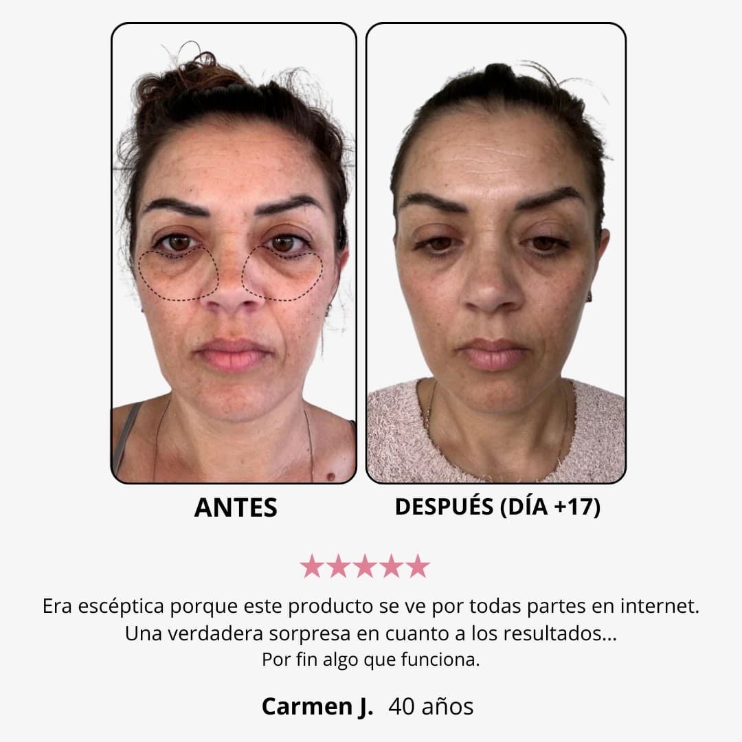 Crema de luz roja para el contorno de ojos